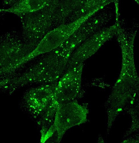 WIPI1 enhances Autophagy and Longevity