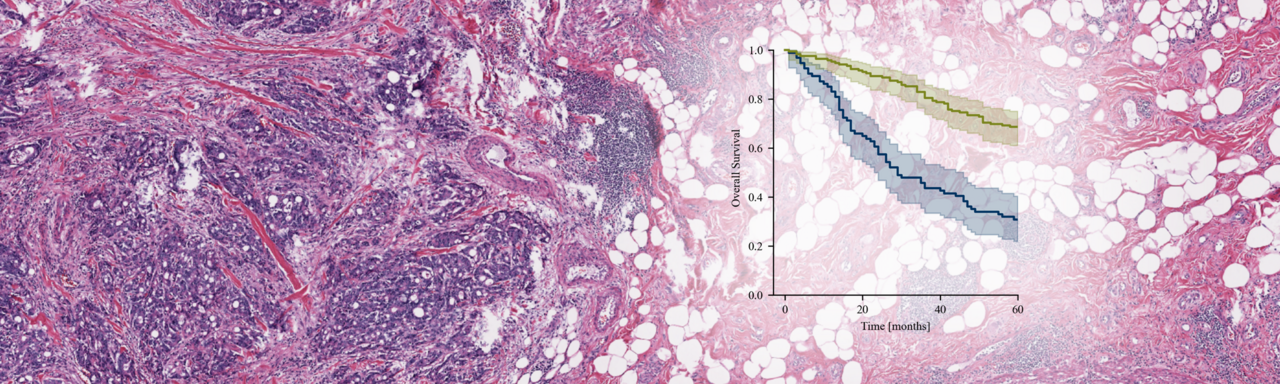 Colorectal cancer risk stratification on histological slides based on survival curves predicted by deep learning