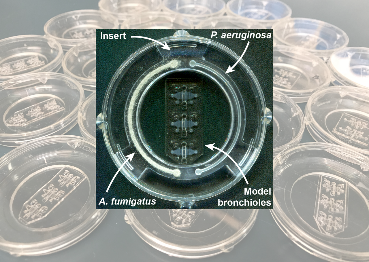 Modeling lung infection in vitro