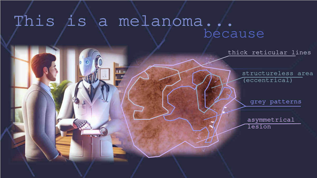 Dermatologist-like explainable AI enhances trust and confidence in diagnosing melanoma