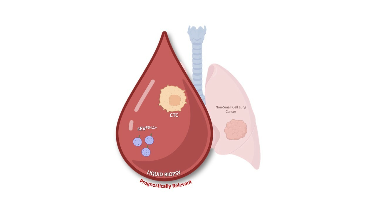 Circulating tumour cells and PD-L1-positive small extracellular vesicles: THE liquid biopsy combination for prognostic information in patients with metastatic non-small cell lung cancer