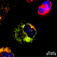 Evaluation of the efficacy of cystinosin supplementation through CTNS mRNA delivery in experimental models for cystinosis