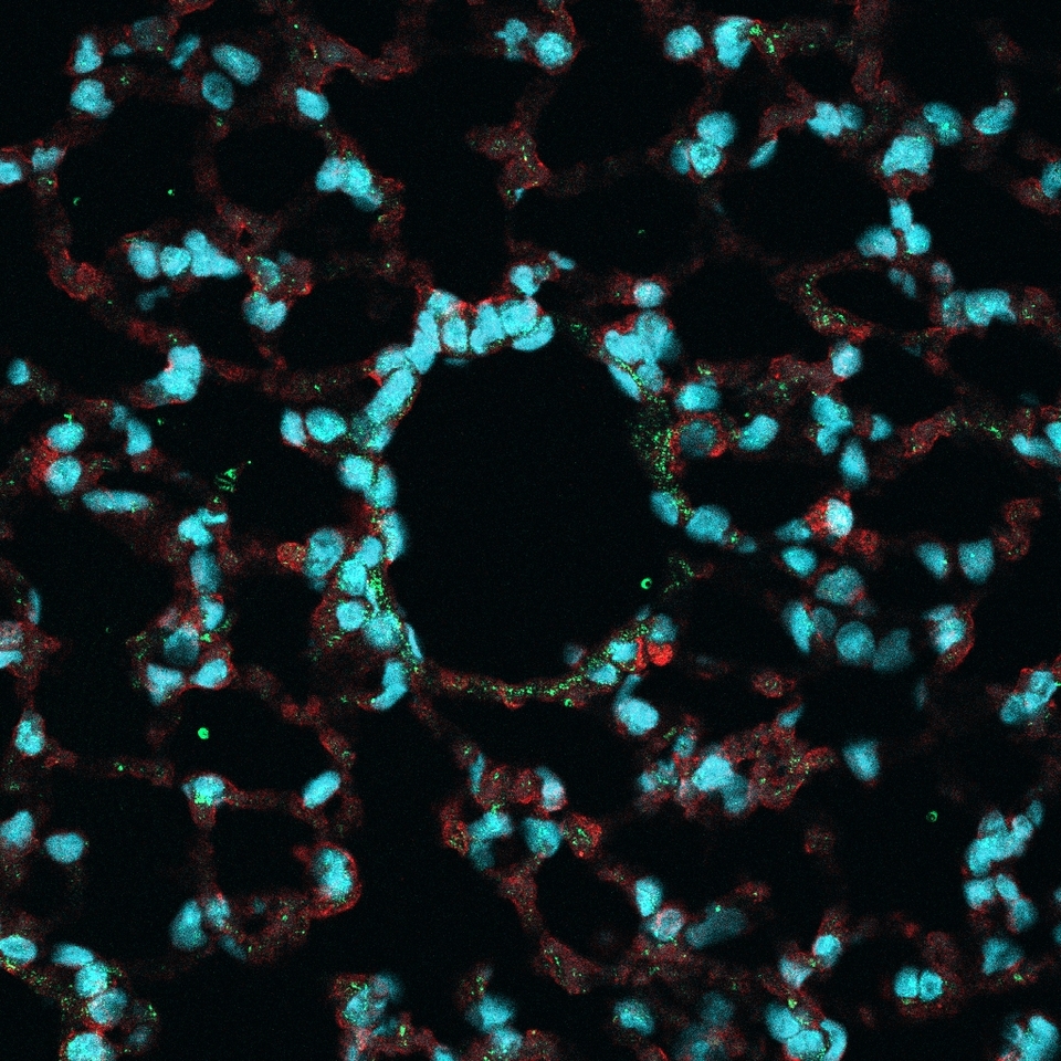 Creating awareness for COPD on World COPD Day 2023