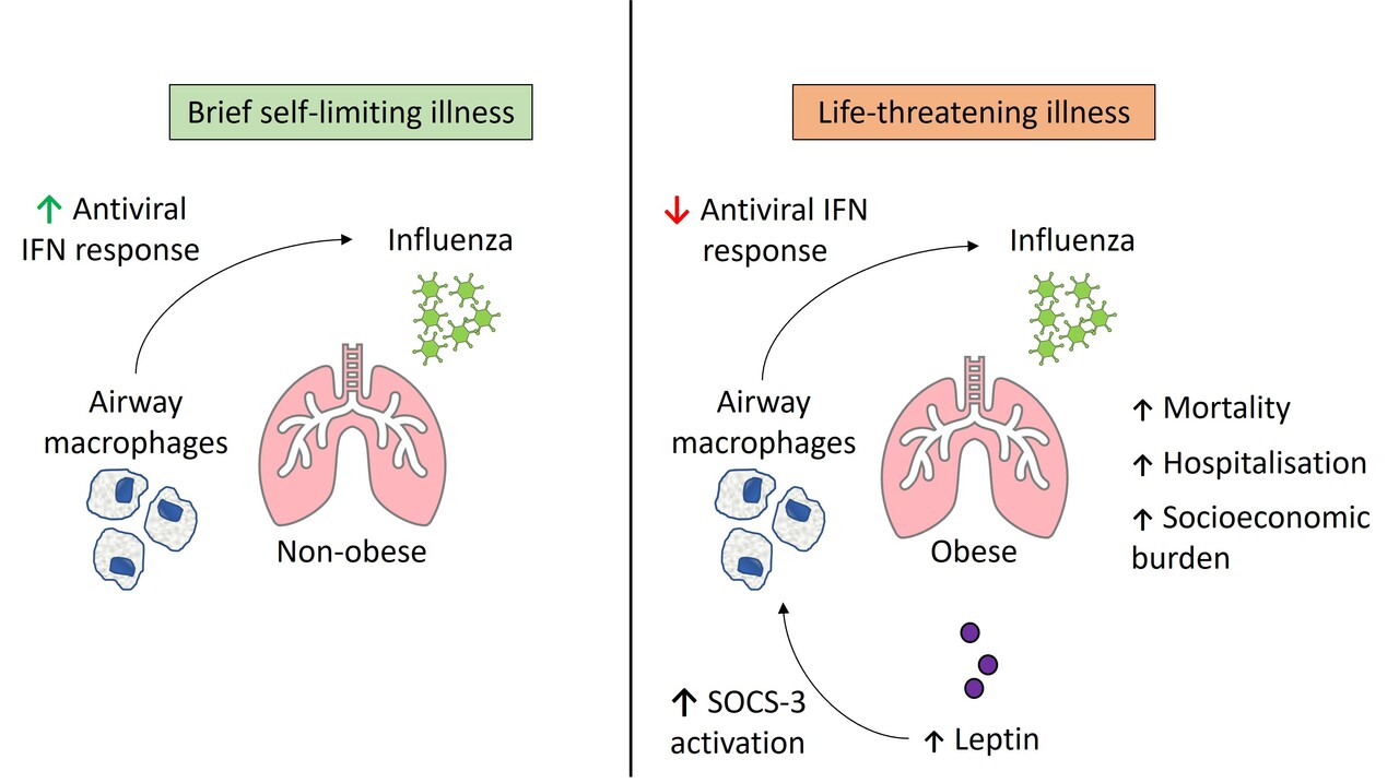 Why obese people are more susceptible to viral infections