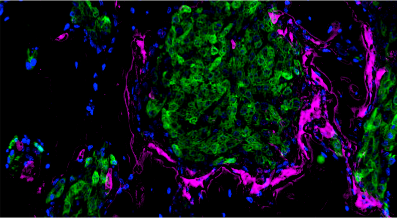 Tumor-Osteoclast Spatiotemporal Coupling: A Cell Behavior Target for Bone Metastasis Prevention
