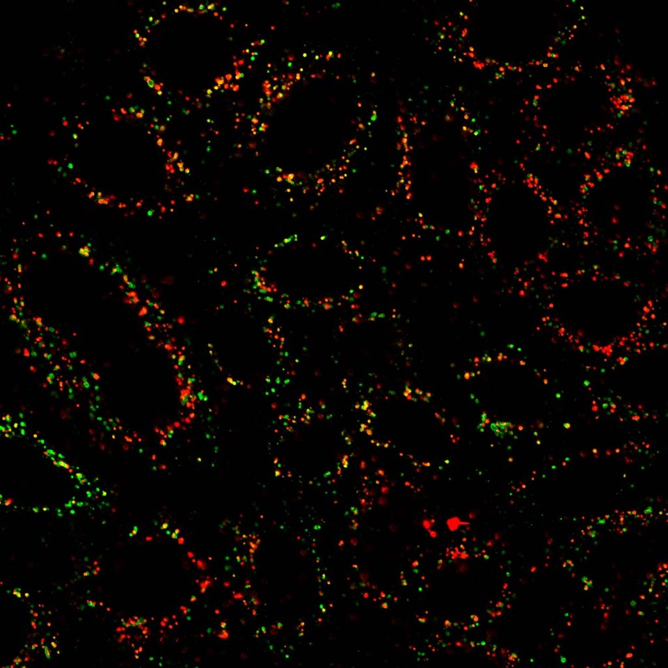 Phosphoglycerate kinase 1 acts as a cargo adaptor for EGFR lysosomal transport