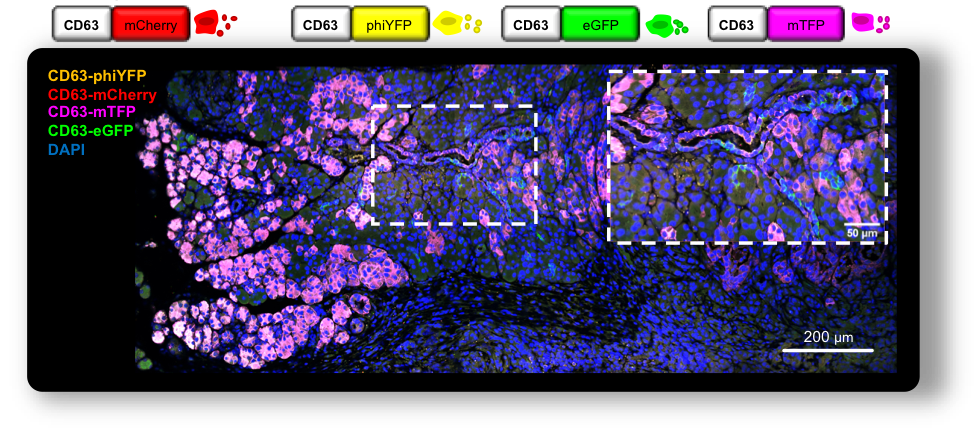 Pancreas and Pancreatic Cancer ExoConnectomes