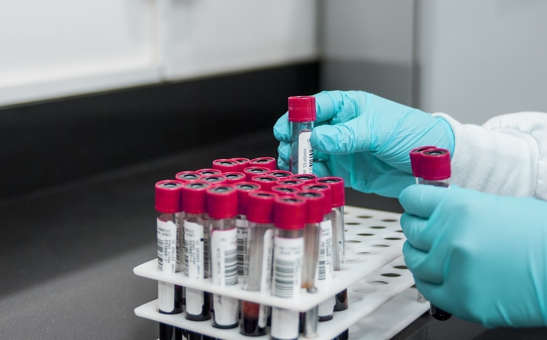 Tumor-educated platelets: biomarker mirage or reality?