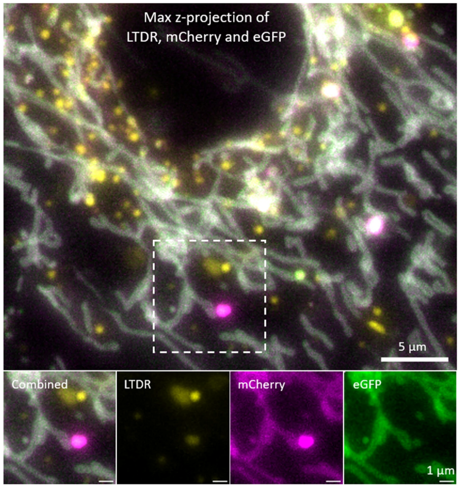 Videos of fluorescent mitochondria and other organelles