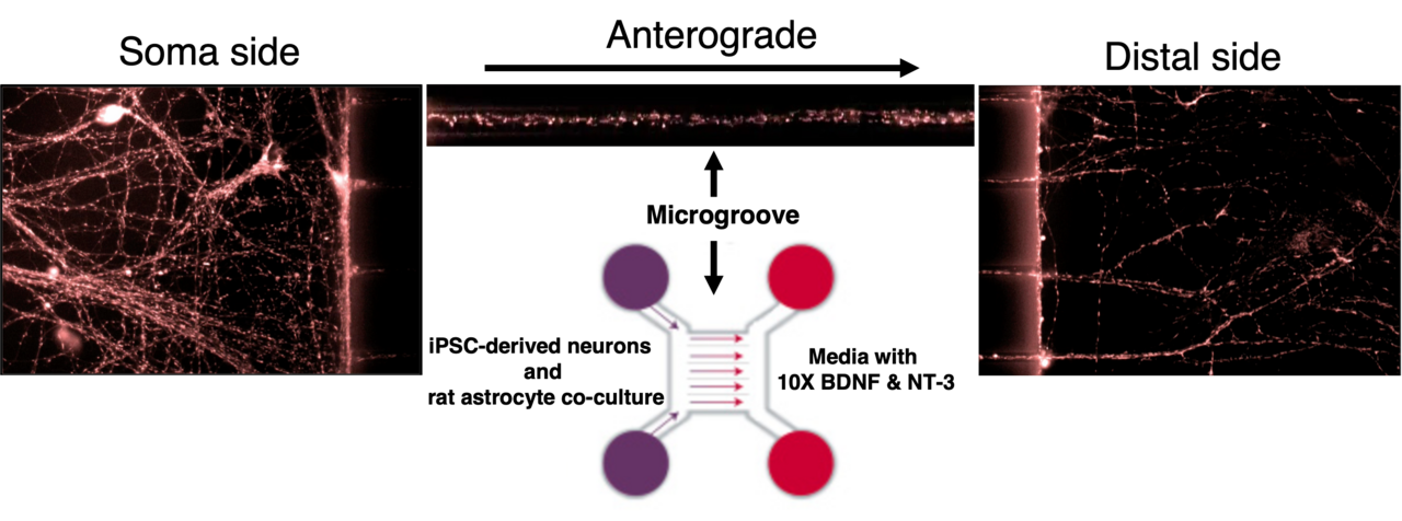 Alzheimer’s disease modelling with human neurons reveals how amyloid cannot exert its toxicity without tau