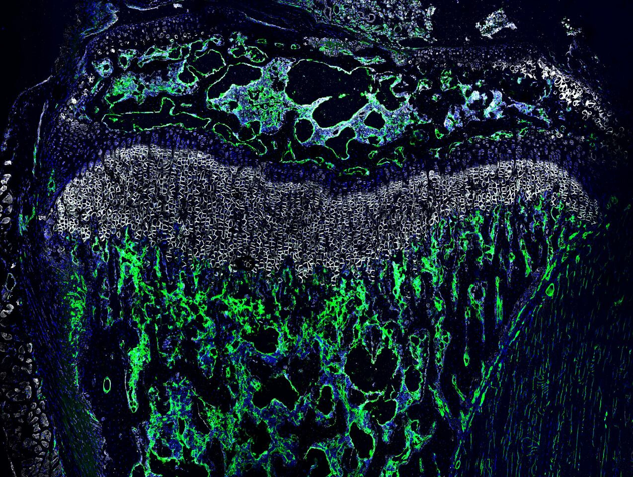 Unraveling the Marvels of Endothelial SMAD1/5 in Juvenile Long Bones
