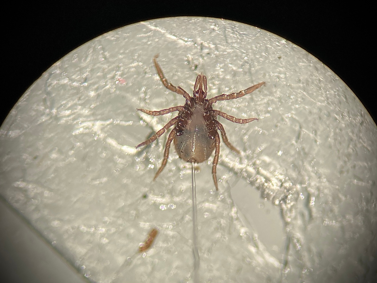 The Hidden Faces of Tick Immune Cells: Navigating Fitness and Microbial Challenges