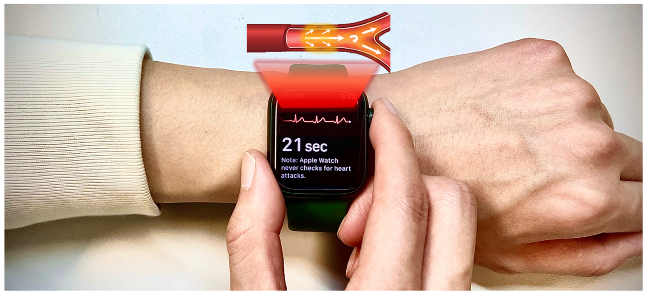 Pioneering a Healthier Future: Wearable Technology Empowers Vascular Age and Heart Health Assessment