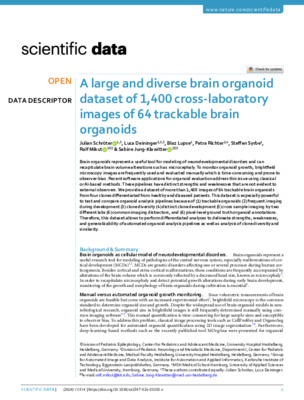 A large and diverse brain organoid dataset of 1,400 cross-laboratory images of 64 trackable brain organoids