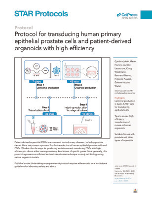 Protocol for transducing human primary epithelial prostate cells and patient-derived organoids with high efficiency