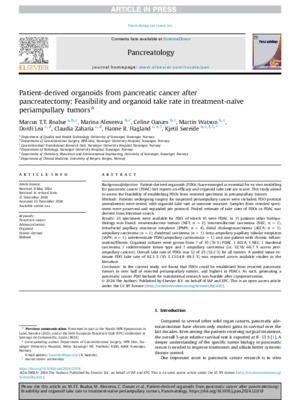 Patient-derived organoids from pancreatic cancer after pancreatectomy: Feasibility and organoid take rate in treatment-naïve periampullary tumors