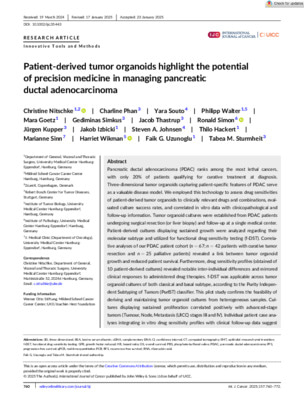 Patient-derived tumor organoids highlight the potential of precision medicine in managing pancreatic ductal adenocarcinoma