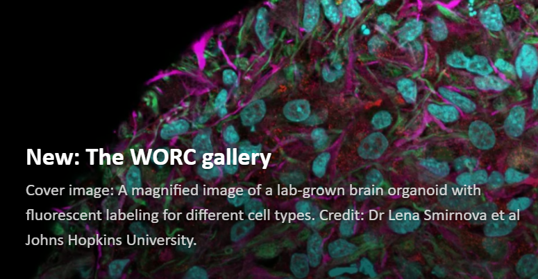 The WORC Community Gallery is now open!....  