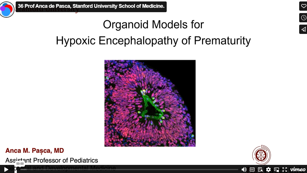 EXCLUSIVE: Watch Assistant Professor Anca de Pasca, Stanford University School of Medicine