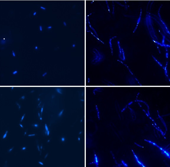 Understanding multiple antibiotic resistance