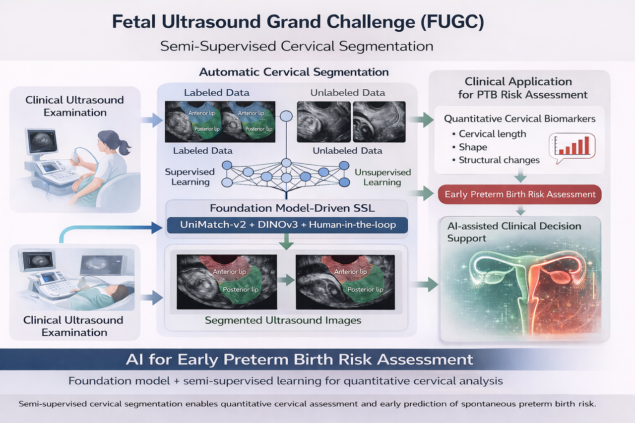 Jieyun Bai's Challenge Paper"FUGC: Benchmarking Semi-Supervised Learning Methods for Cervical Segmentation”