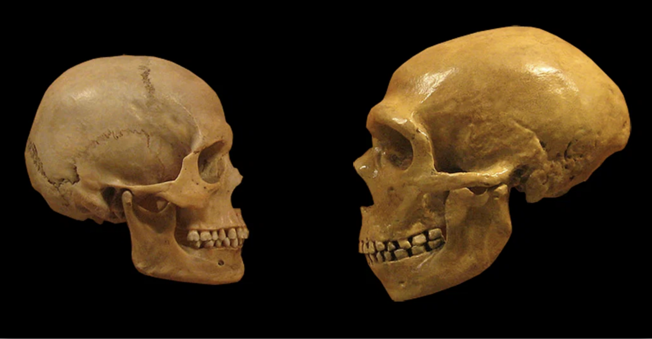 Neanderthal DNA Implicated in Autism Susceptibility