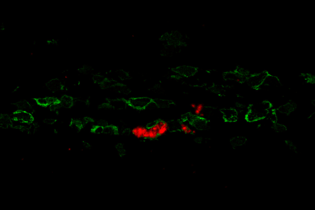 Deciphering Bat Influenza: New Insights into H18N11 Infection Dynamics