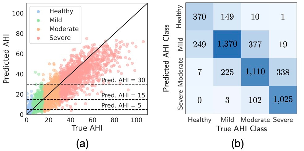 Towards Automatic Home-Based Sleep Apnea Estimation Using Deep Learning