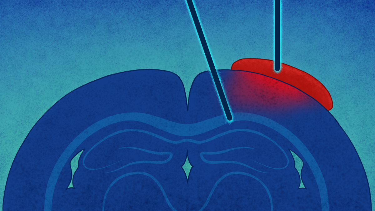 Electrokinetic Convection-Enhanced Delivery to infuse macromolecules into the brain