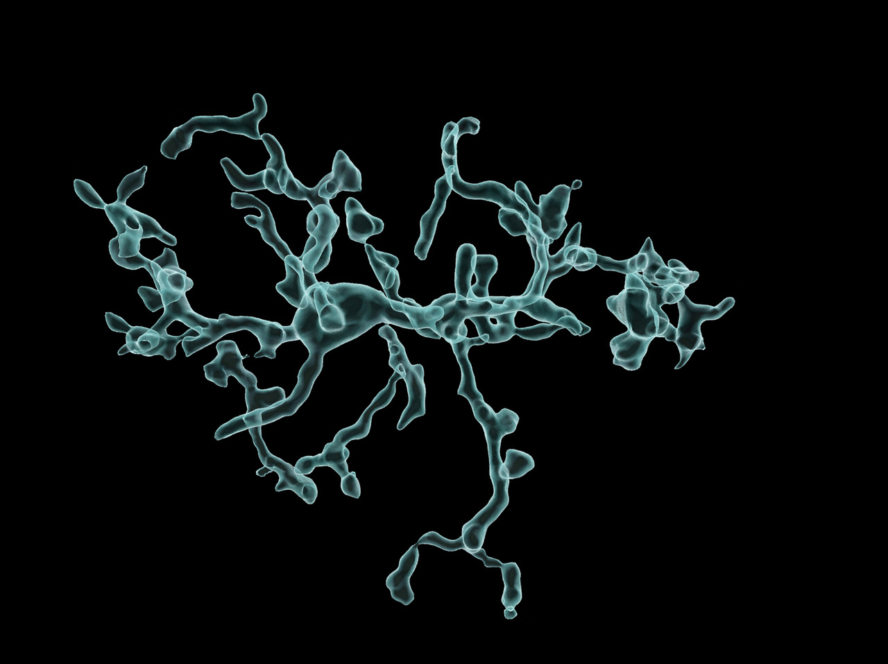 Dysfunctional microglial mitochondria impair brain development