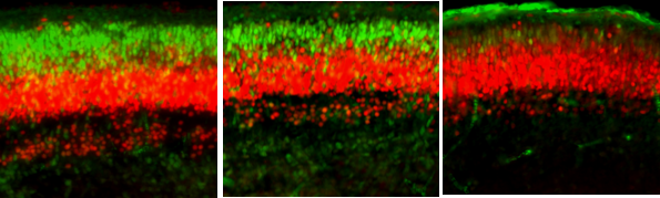 Severe flu infection during pregnancy disrupts the developing fetal brain