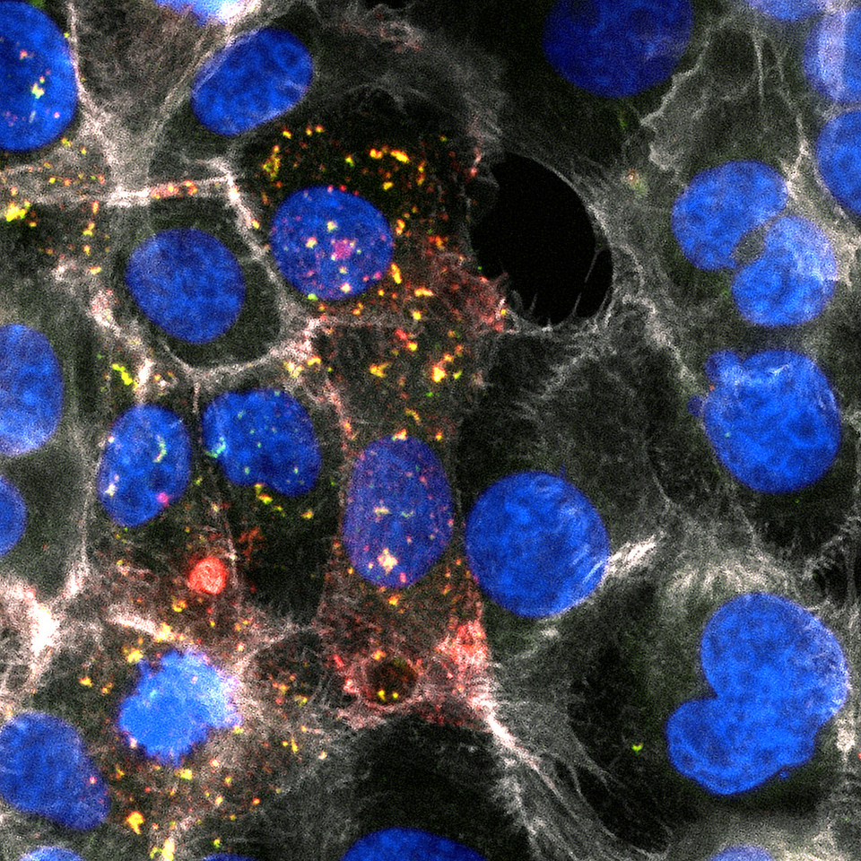 The Sugar Crush of the Fungal Toxin Candidalysin