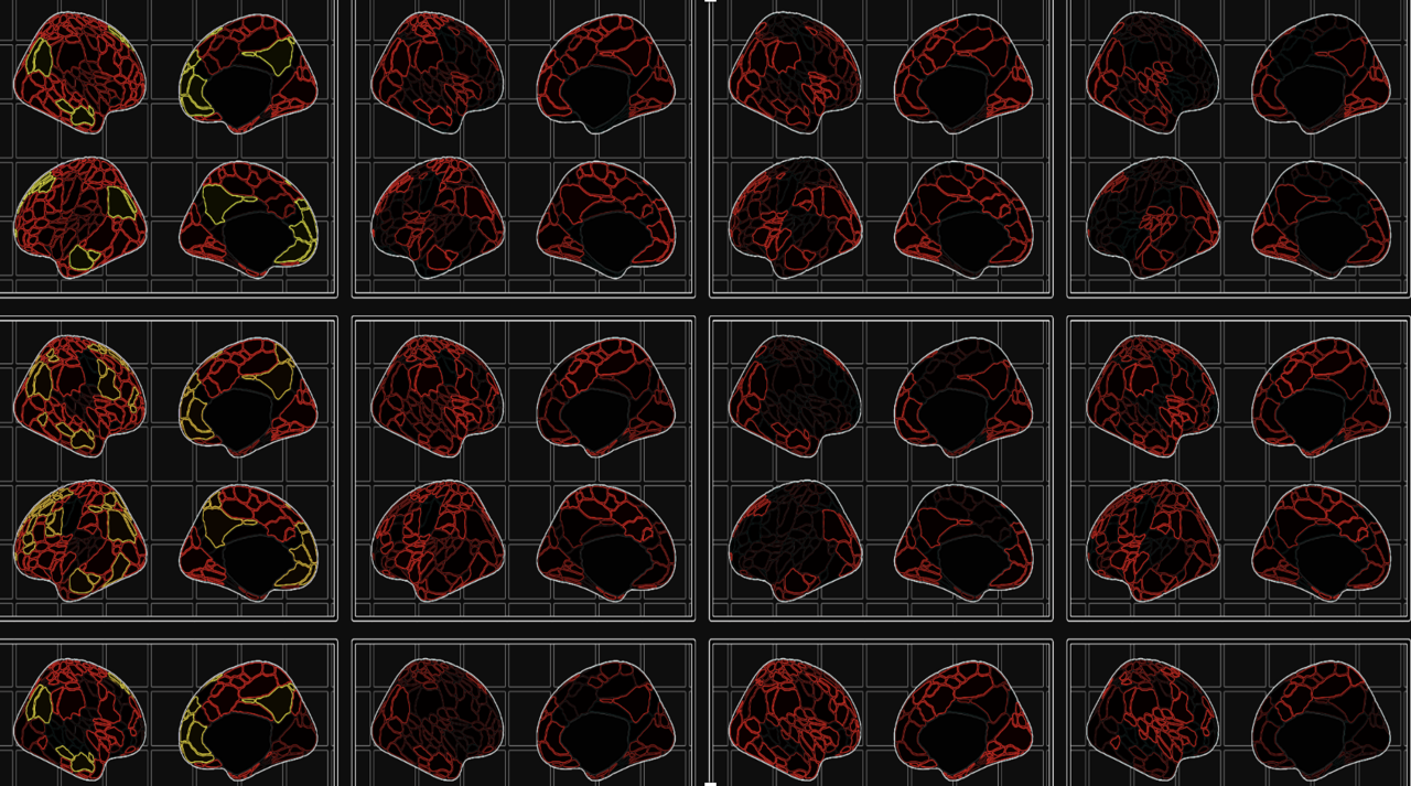 Mapping the Neurodevelopmental Predictors of Psychopathology