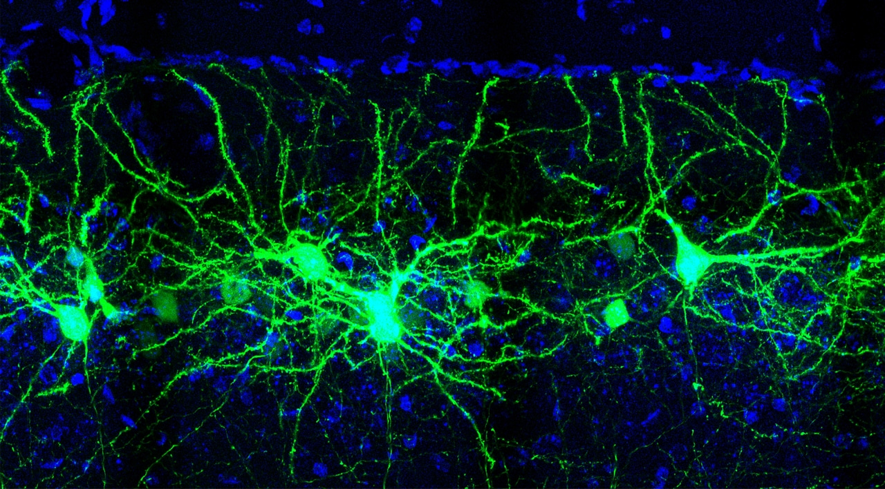 Beyond Phagocytosis: The Intracellular Complement Pathway in Synaptic Dysregulation