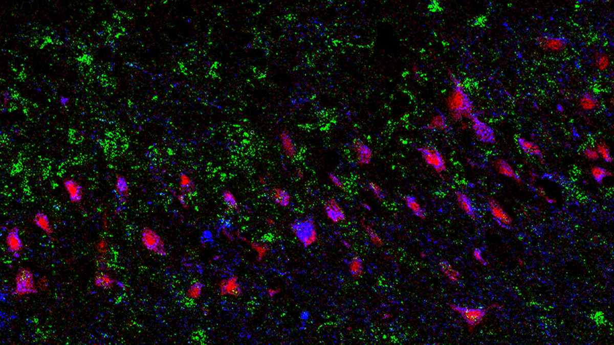 Do astrocytes of the human brain breathe?