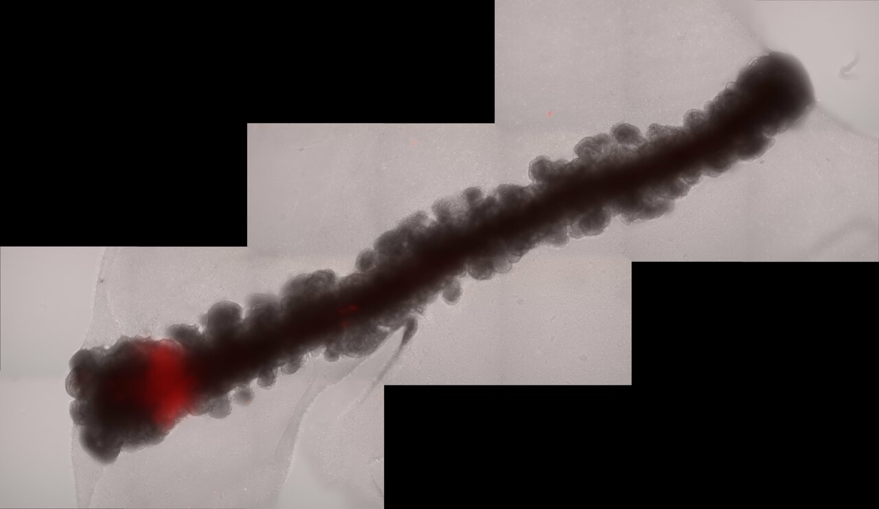 FGF8 as Director of the Fronto-Temporal Cortical Patterning Orchestra