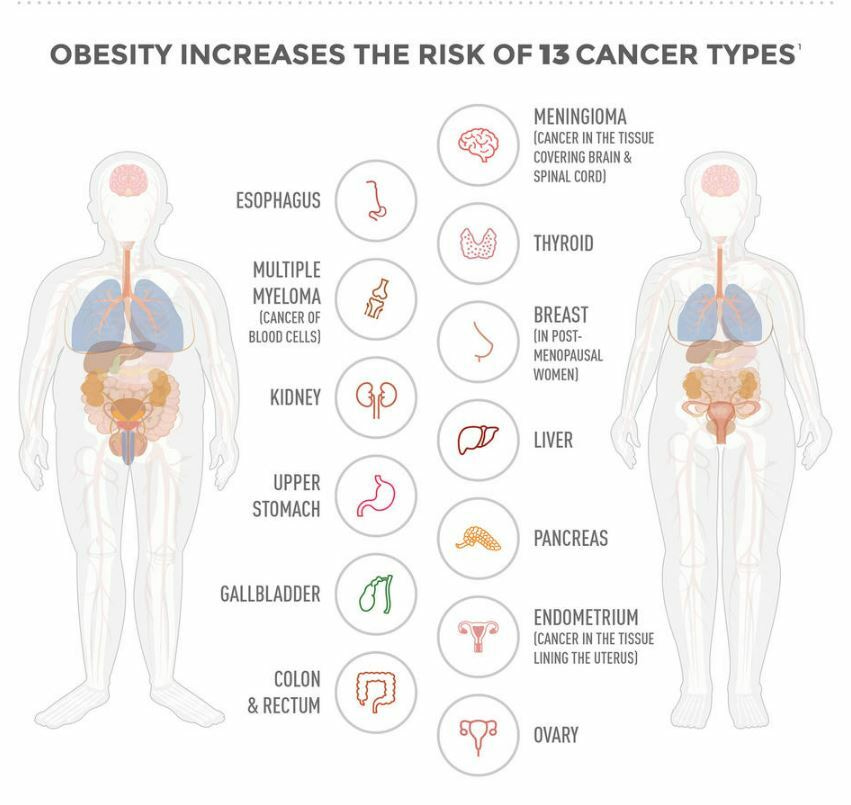 Are your metabolic obesity phenotypes associated with the risk of overall and site-specific cancers?