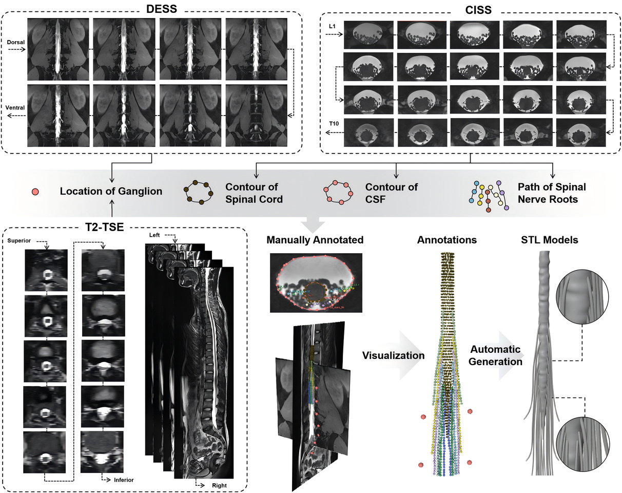 An open-access lumbosacral spine MRI dataset with enhanced spinal nerve root structure resolution
