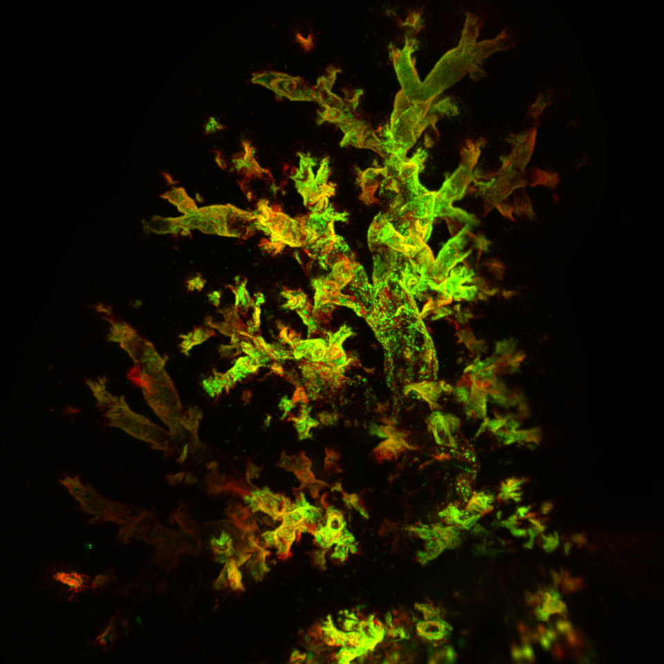 Murine parainfluenza virus persists in lung innate immune cells sustaining chronic lung pathology