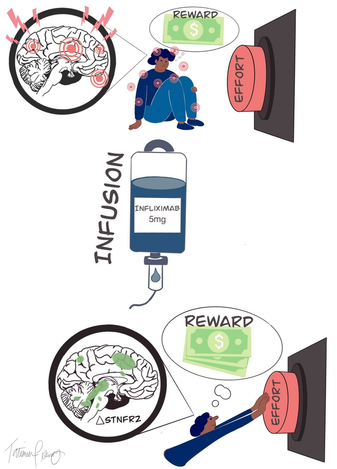 New Anti-Inflammatory Drug Boosts Motivation in Depression Patients