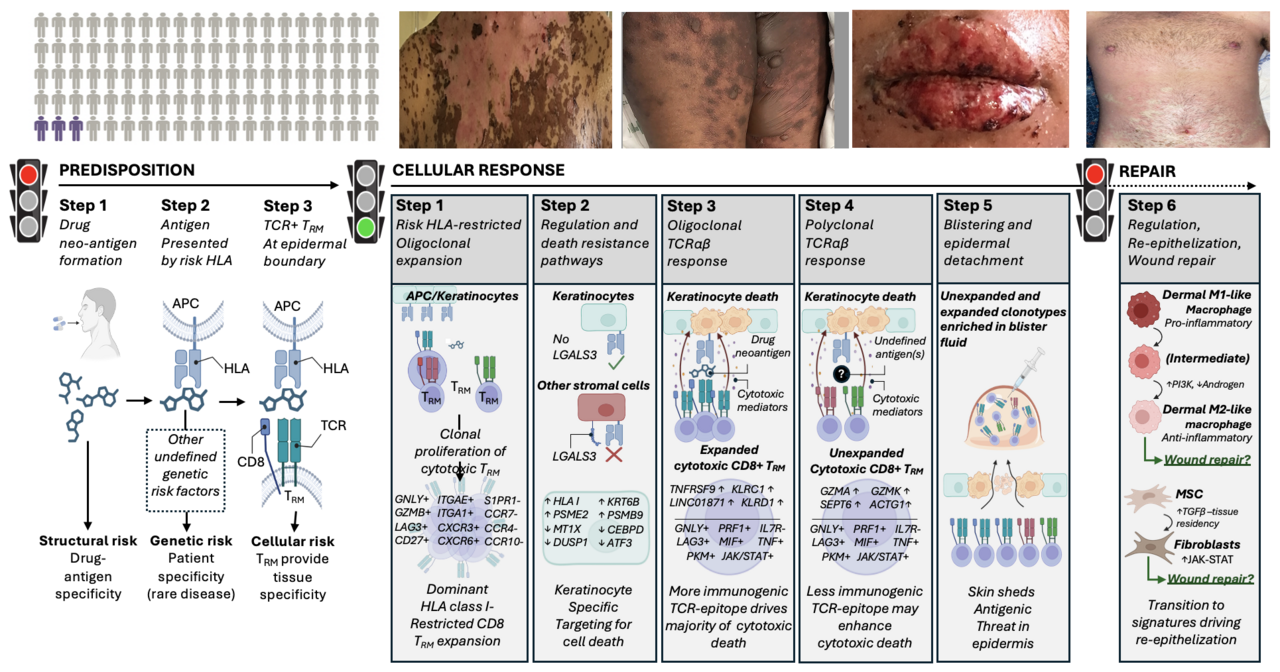 Multiomic single-cell sequencing defines tissue-specific responses in Stevens-Johnson syndrome and toxic epidermal necrolysis