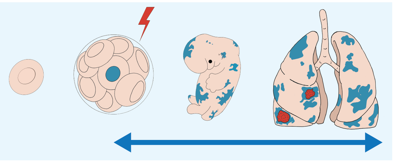 Unraveling the Causes of Multiple Early-Stage EGFR-Mutant Lung Cancers
