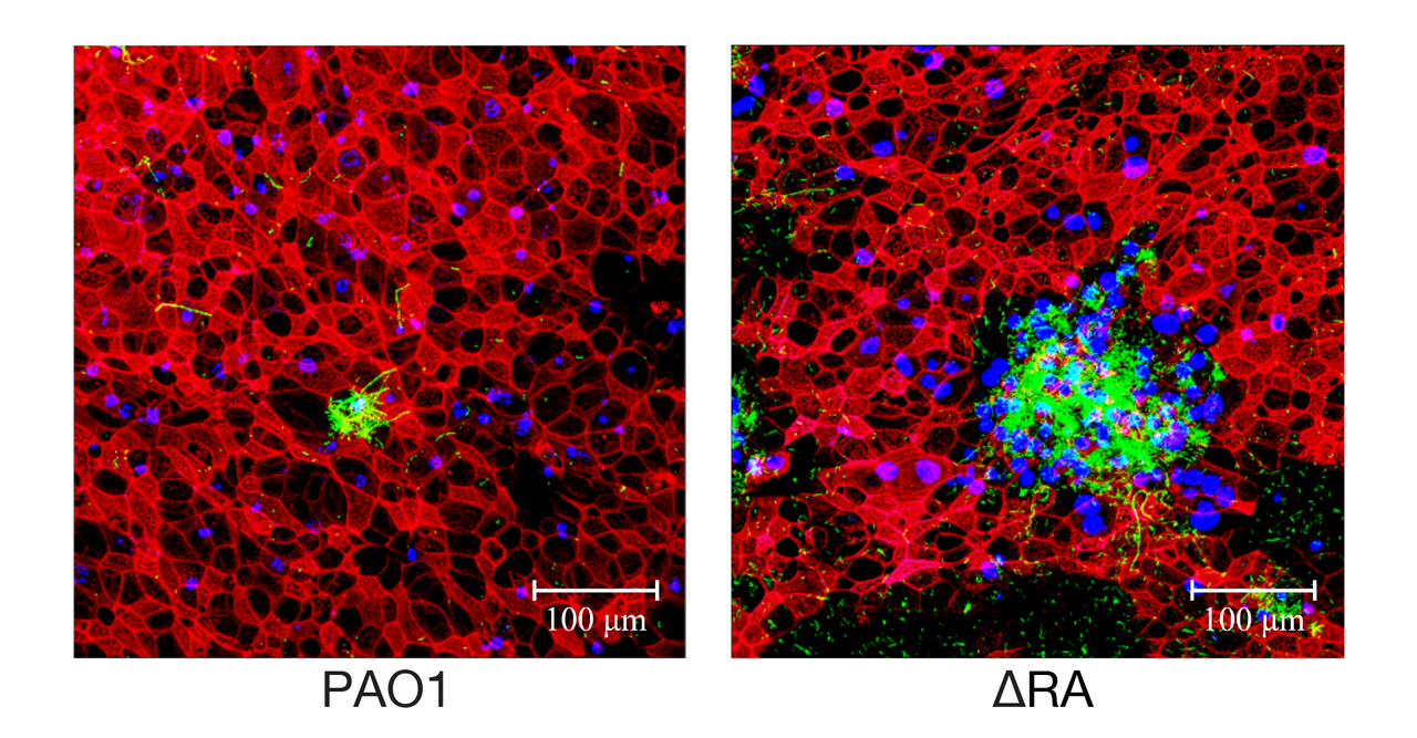The paradox of macrolide resistance in Pseudomonas aeruginosa