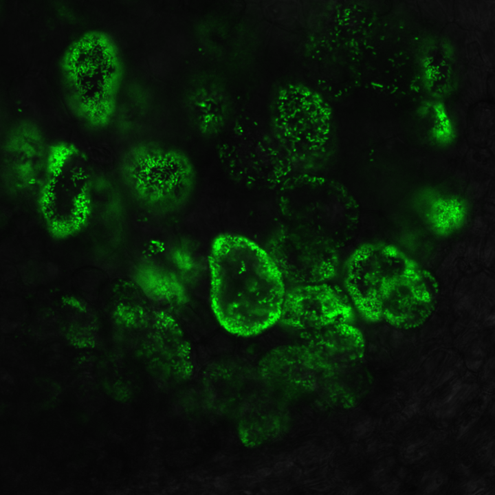 Atypical bacteria and the blurry frontiers between pathogens and symbionts