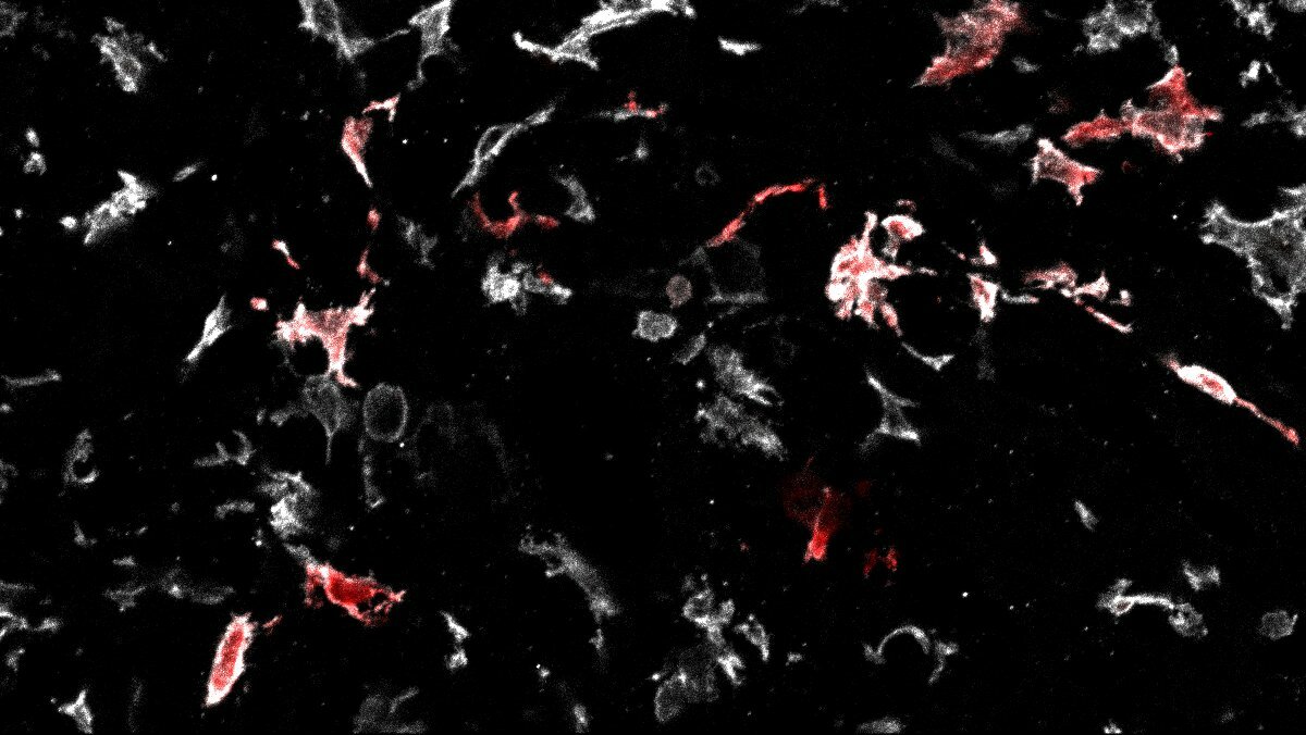 Embryonic-derived macrophages join the party of evil when seats are available