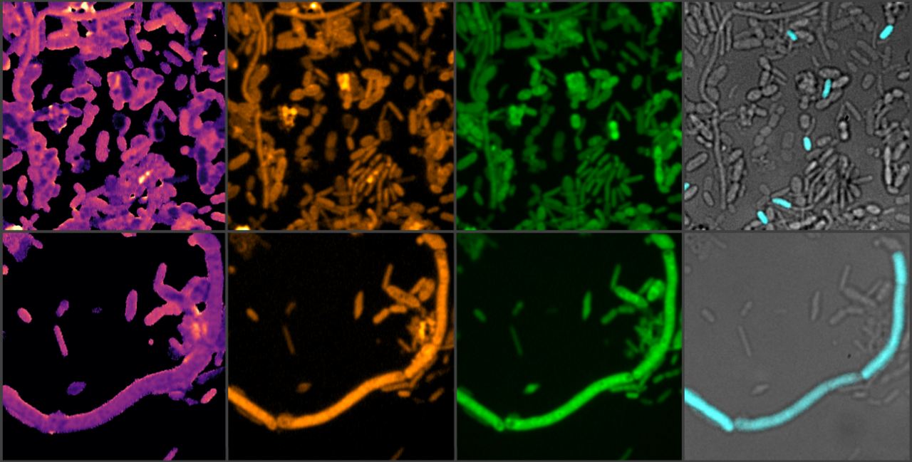 Beyond the target: how a Parkinson's drug doubles up as an inducer of microbial iron starvation