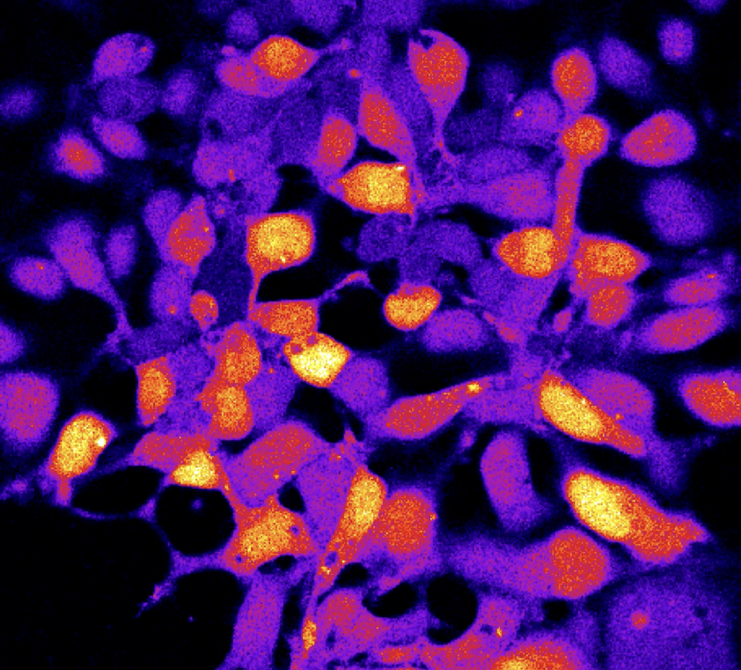 Cannabinoids Modulate Angiotensin II-Induced Calcium Signaling in Striatal Neurons: Implications for Parkinson's Disease