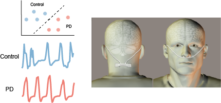Discriminating Parkinson’s Disease Patients from Healthy Controls Using Nasal Respiratory Airflow
