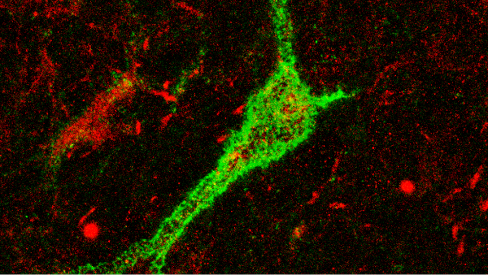 Early-Life Stress and Schizophrenia: Exploring the Role of Inhibitory Neurons in the Thalamus