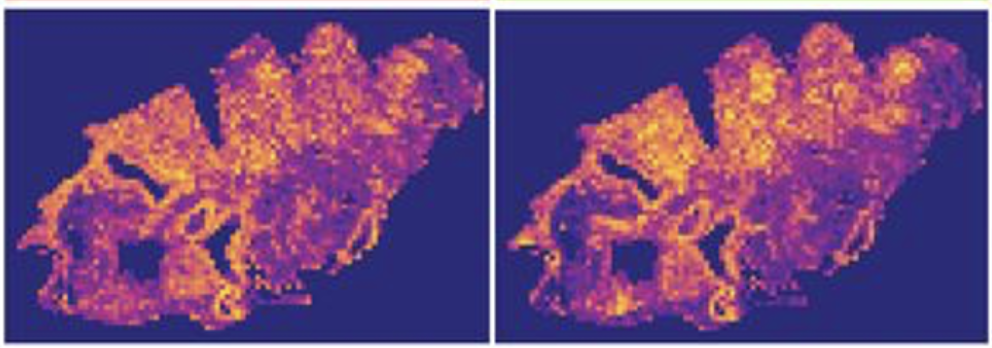Seeing the Unseen: HistoTME's AI Vision Reveals Secrets of the Lung Cancer Tumor Microenvironment